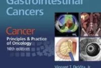 Colon and Other Gastrointestinal Cancers 10th Edition PDF Free Download