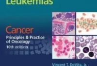 Download Lymphomas and Leukemias Cancer Principles & Practice of Oncology 10th edition PDF Free
