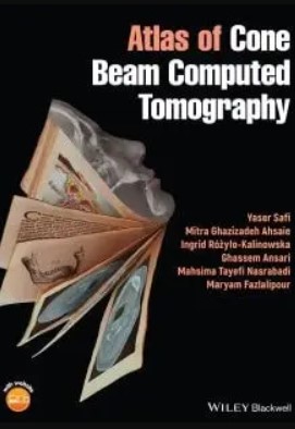Atlas of Cone Beam Computed Tomography PDF Free Download