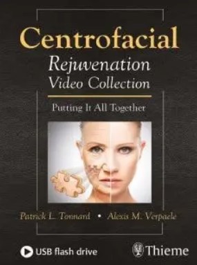 Centrofacial Rejuvenation Video Collection Putting It All Together PDF Free Download