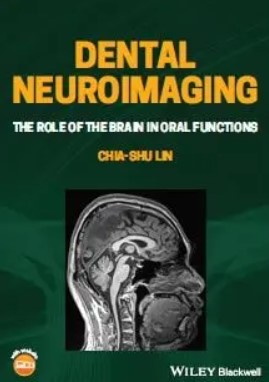Dental Neuroimaging The Role of the Brain in Oral Functions PDF Free Download