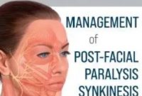 Management of Post-Facial Paralysis Synkinesis PDF Free Download
