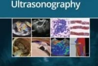 Atlas of Endoscopic Ultrasonography 2nd Edition PDF Free Download