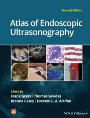 Atlas of Endoscopic Ultrasonography 2nd Edition PDF Free Download