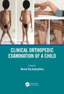 Clinical Orthopedic Examination of a Child PDF Free Download