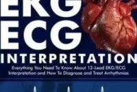 Download EKG-ECG Interpretation Everything you Need to Know about the 12-Lead ECG-EKG 2nd edition PDF Free