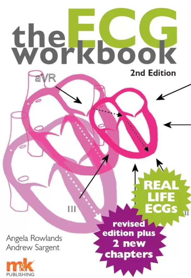 The ECG Workbook 2nd Edition PDF Free Download